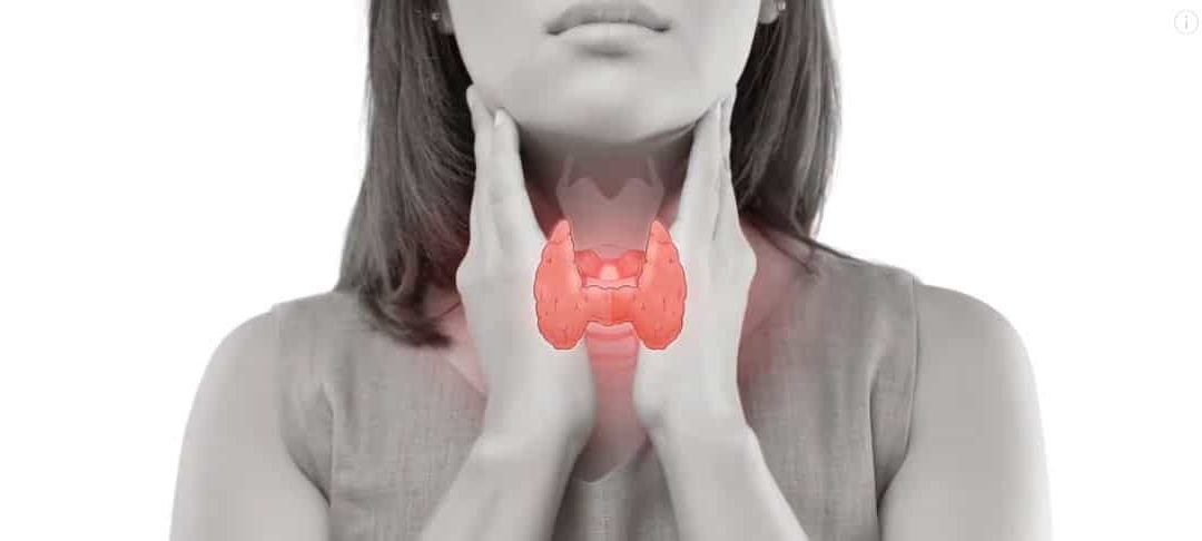 3 Hashimoto’s Thyroiditis Symptoms