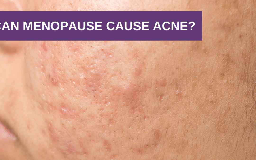 Can Menopause Cause Acne?