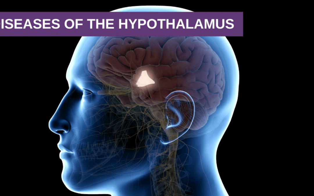 Diseases of the Hypothalamus