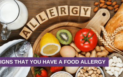Signs That You Have a Food Allergy