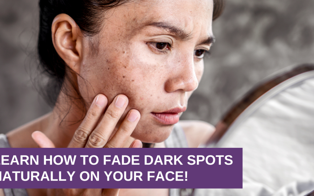 Learn How To Fade Dark Spots Naturally on Your Face!